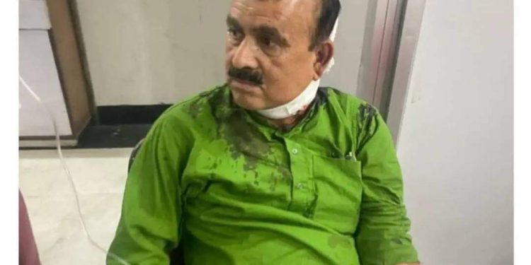 कांग्रेसका सहमहामन्त्री यादवमाथि सांघातिक आक्रमण