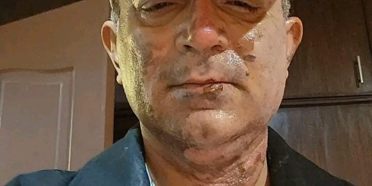 पोखराका मेयर धनराज आचार्य डिस्चार्ज